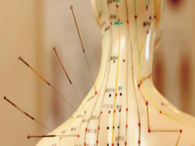 Acupuntura